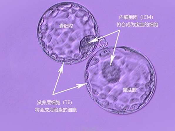 试管婴儿囊胚质量等级的具体标准是什么？试管婴儿囊胚培育时可以将囊胚分为哪几个时期？