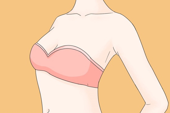 乳房悬吊棒棒糖手术方式 乳房悬吊棒棒糖手术方式是什么