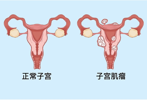 试管婴儿费用