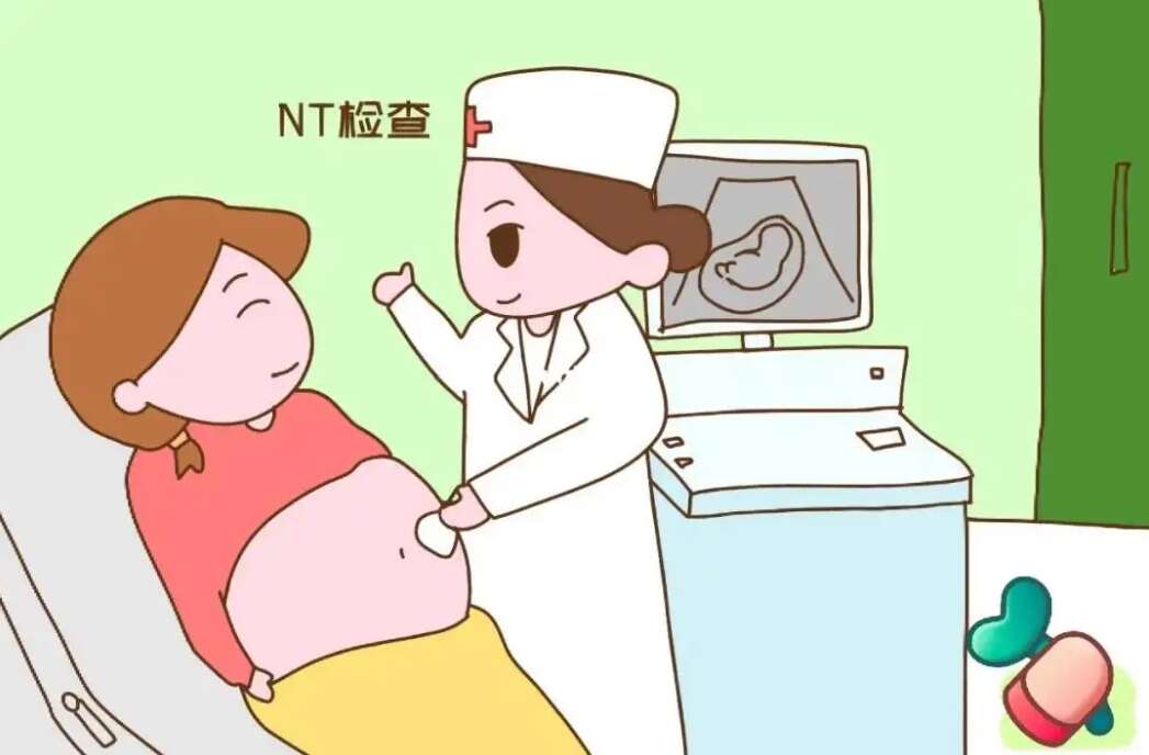 NT检查是什么