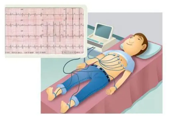 什么是心电图检查