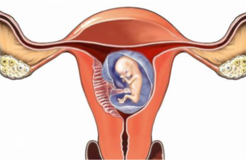 单角子宫能正常怀孕吗？这两种治疗方法要记住
