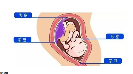 民间怀孕看前后壁准不准，带你深入了解一下真相