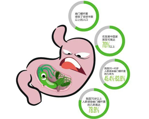 14岁以下儿童不建议检查幽门螺杆菌