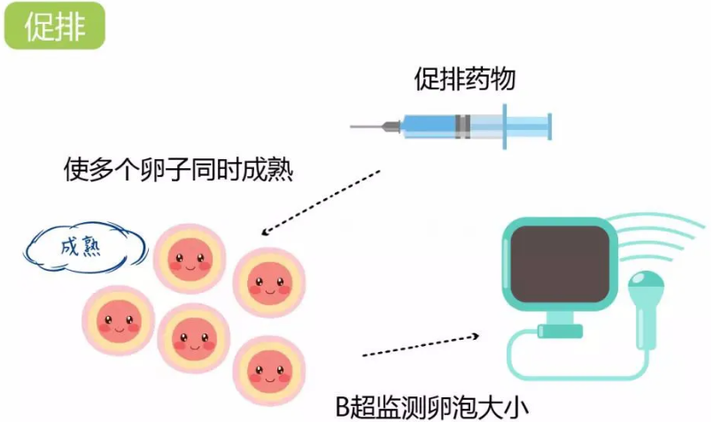 试管婴儿的详细步骤流程是什么