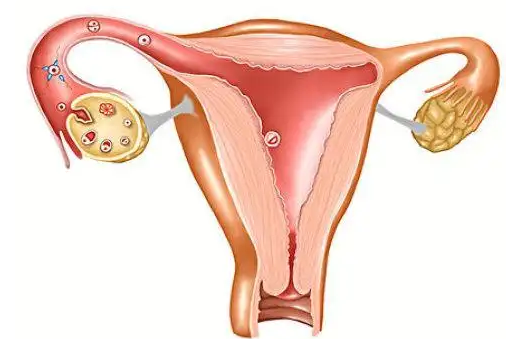 多囊女性试管促排取出来的卵子质量怎么样？