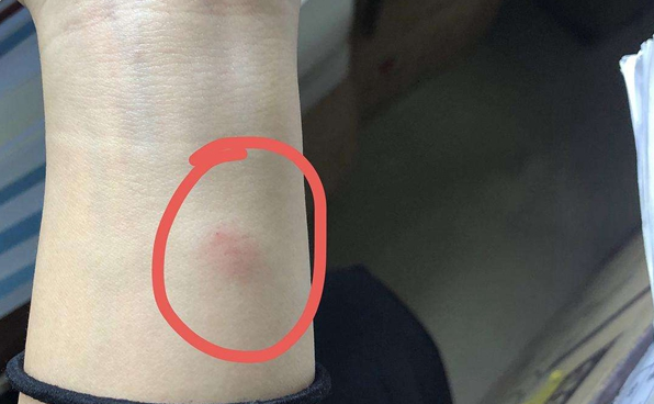 ppd实验强阳性会影响怀孕吗？