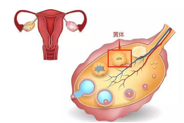 取卵后卵巢多发黄体囊肿怎么办，两个月没消除能移植冻胚吗？