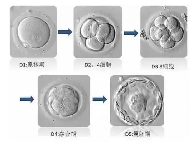 打两针降调移植冻胚时间，选择什么方案还不好说