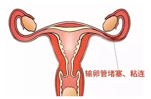myzx530018841853433002.png