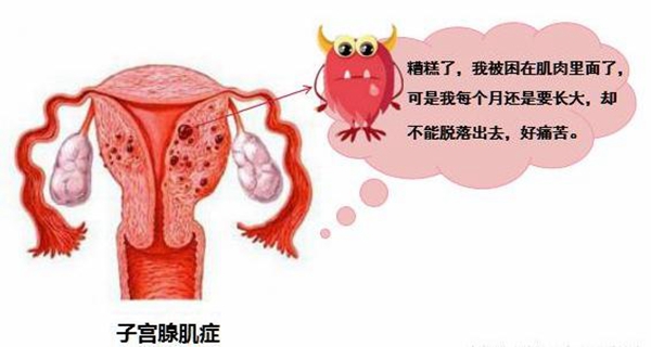 解决子宫腺肌症痛经的方法，让你远离痛经