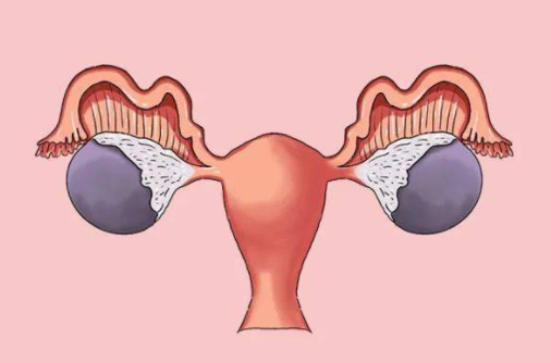 压迫子宫卵巢，后果几何？卵巢囊肿压迫子宫有危害吗？