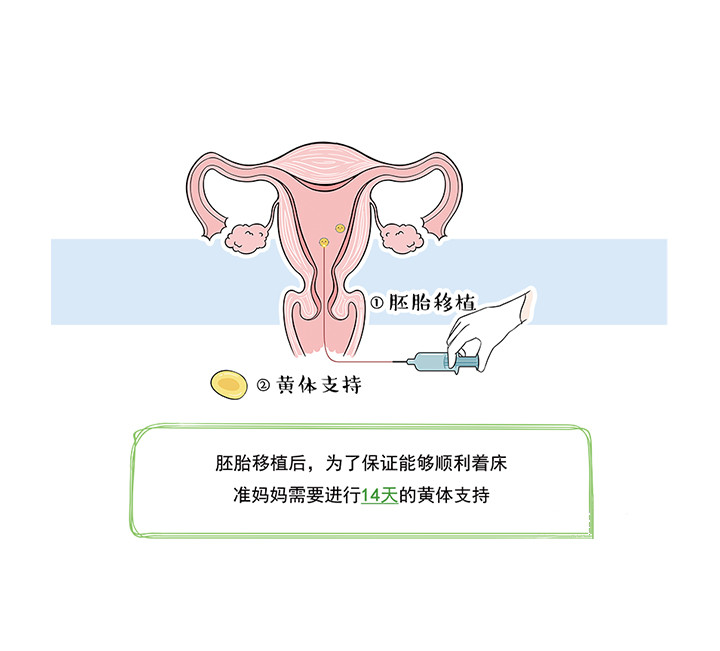 【收藏】试管婴儿胚胎移植手术流程及注意事项大全