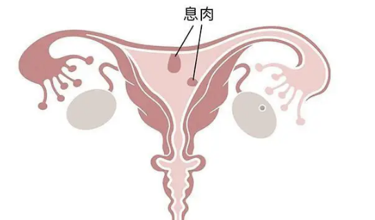 myzx350011843973228002.png