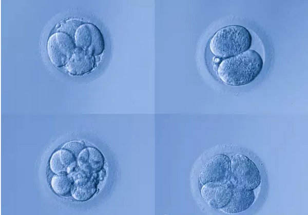 胚胎等级划分与优质胚胎的关键因素探讨