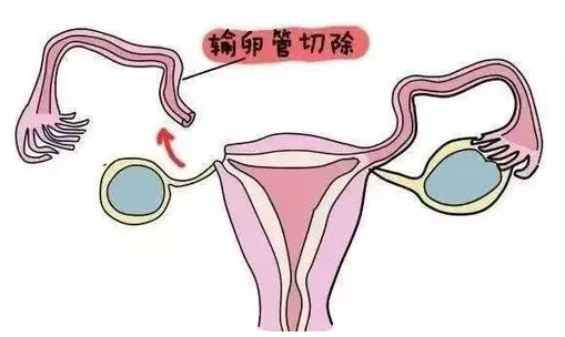 myzx330011991167106002.png