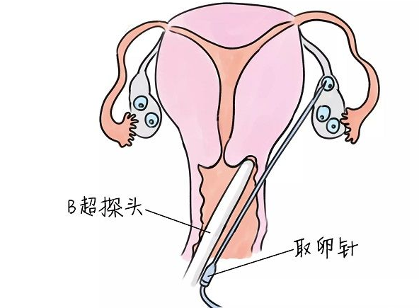 去韶关市看卵巢早衰治疗医院哪家好？试管医院情况清清楚楚