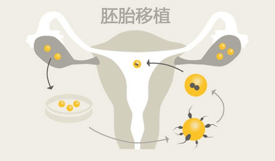 去古交市看卵巢早衰治疗医院哪家好？试管医院情况清清楚楚