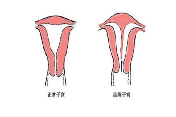 去运城市看卵巢早衰治疗医院哪家好？试管医院情况清清楚楚