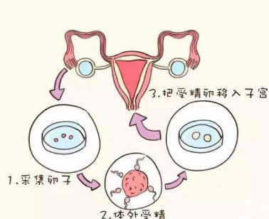 廊坊公立医院不孕不育（廊坊治疗不孕不育有名的医院）
