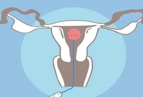 北京试管婴儿去上海名医在线（做试管婴儿去北京哪家医院好）