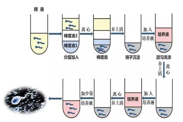 北京第三医院三代试管婴儿移植是怎么做的（北京第三医院三代试管婴儿）