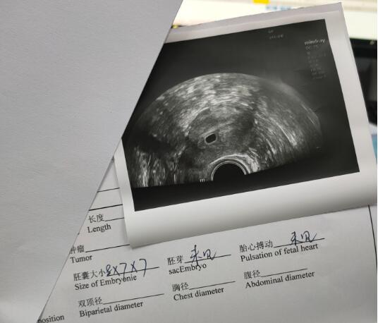 2025江门助孕指南，试管婴儿医院成功率排行、费用估算