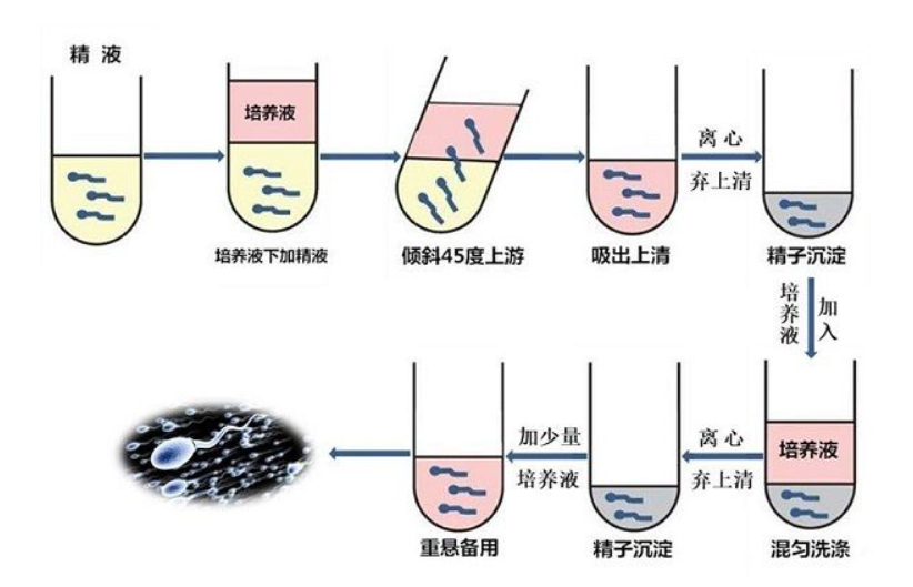 不孕不育症治医生（不孕不育可以治愈要多少钱）