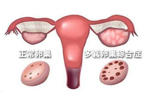 武汉做试管婴儿哪里更好？最新医院排名出来了